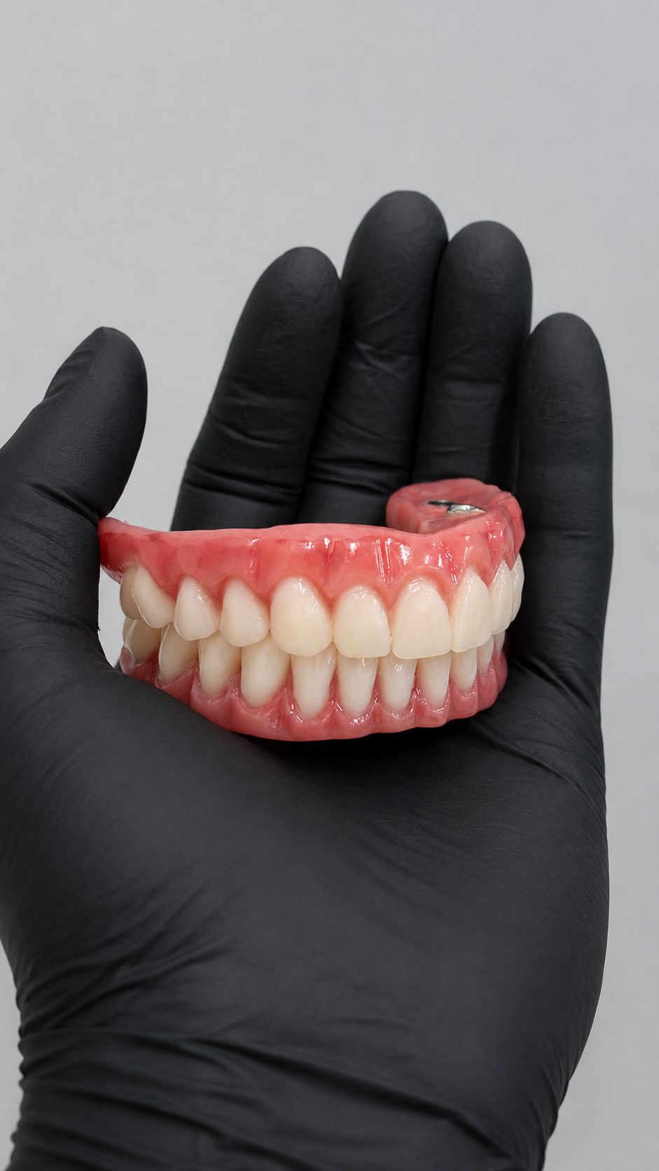 Prótese sobre implantes dentários utilizada em reabilitação com dentadura fixa