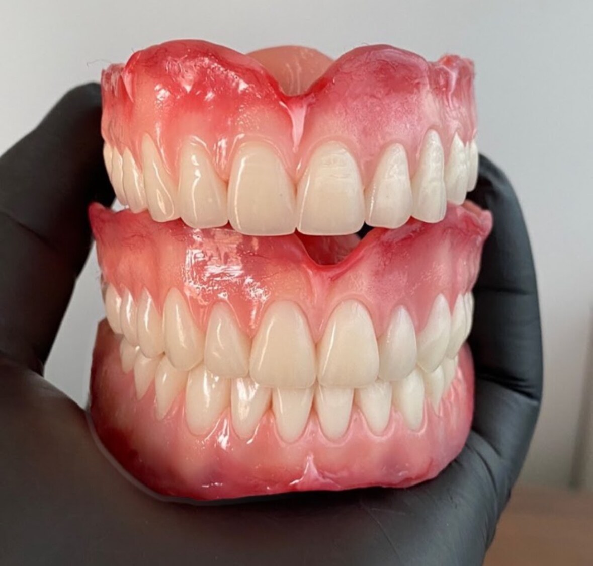 Prótese dentária removível total, arcadas superior e inferior — Odontologia Oliveira, Pouso Alegre