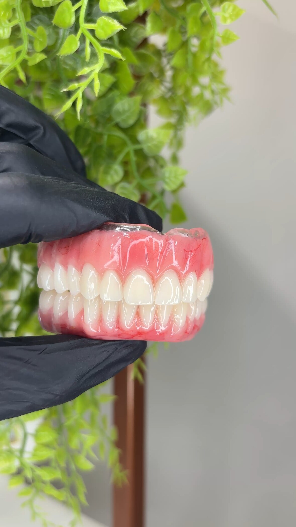 Detalhe de prótese dentária removível total, vista lateral