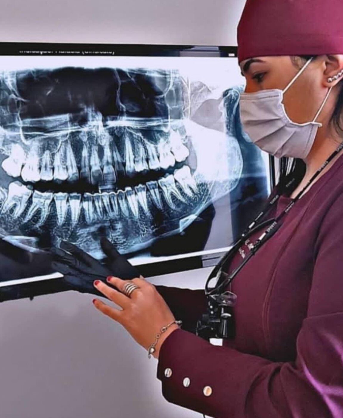 Avaliação de radiografia panorâmica para análise de siso - Odontologia Oliveira, Pouso Alegre